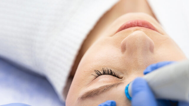 Hydrodermabrasion service